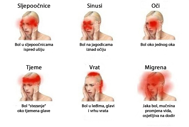 Glavobolje izvan kontrole
