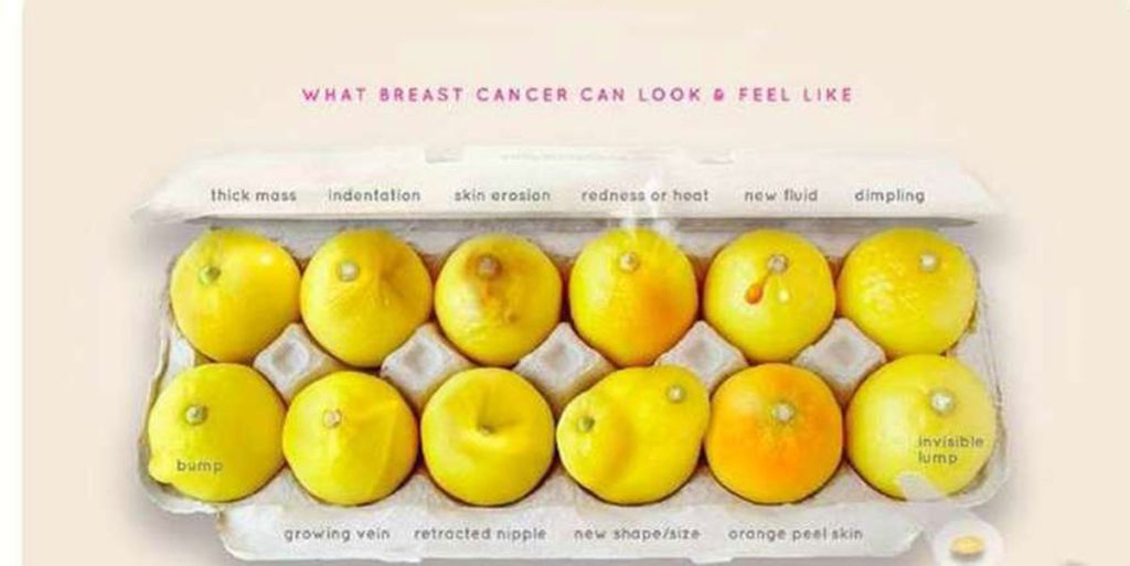 kako rak dojke izgleda