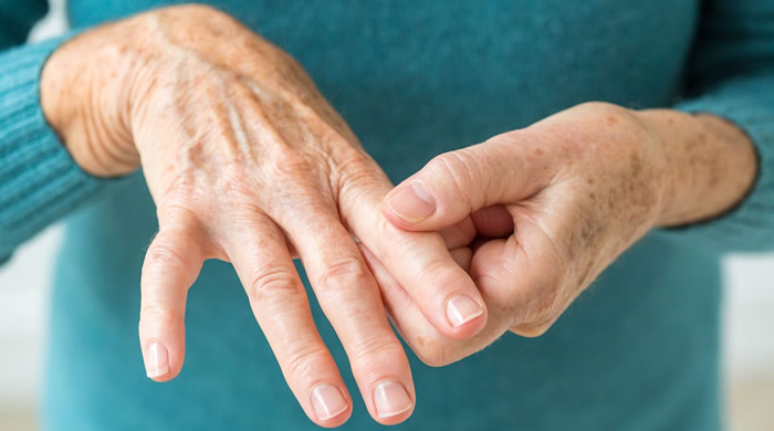 aloe u liječenju artritisa